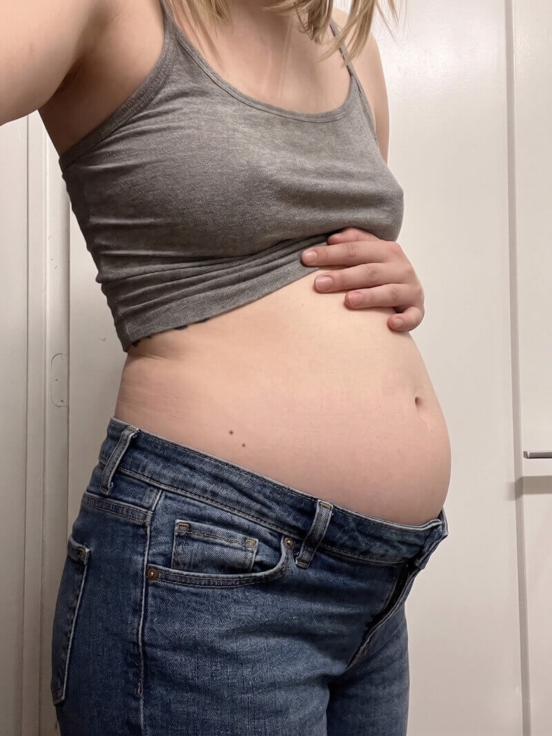 Before — bloated abdomen